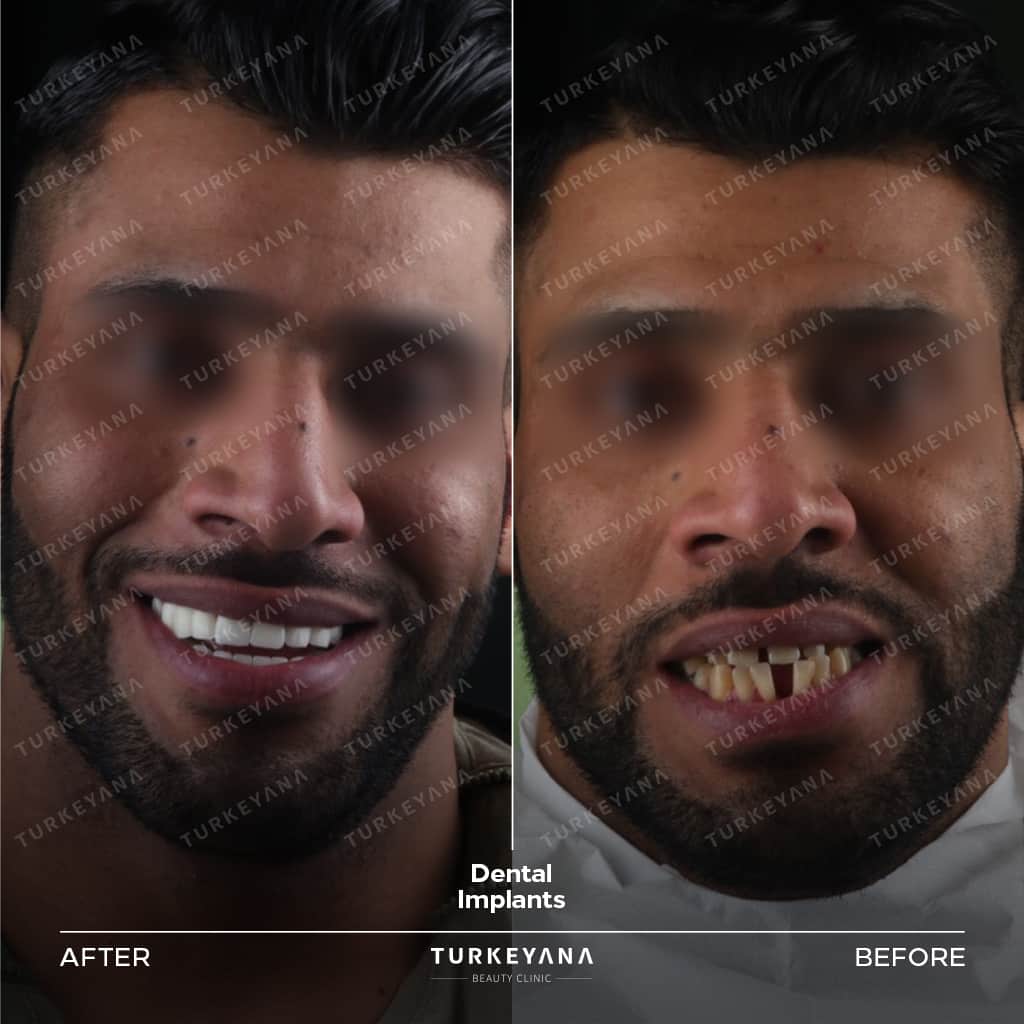 دندانپزشکی زیبایی در استانبول