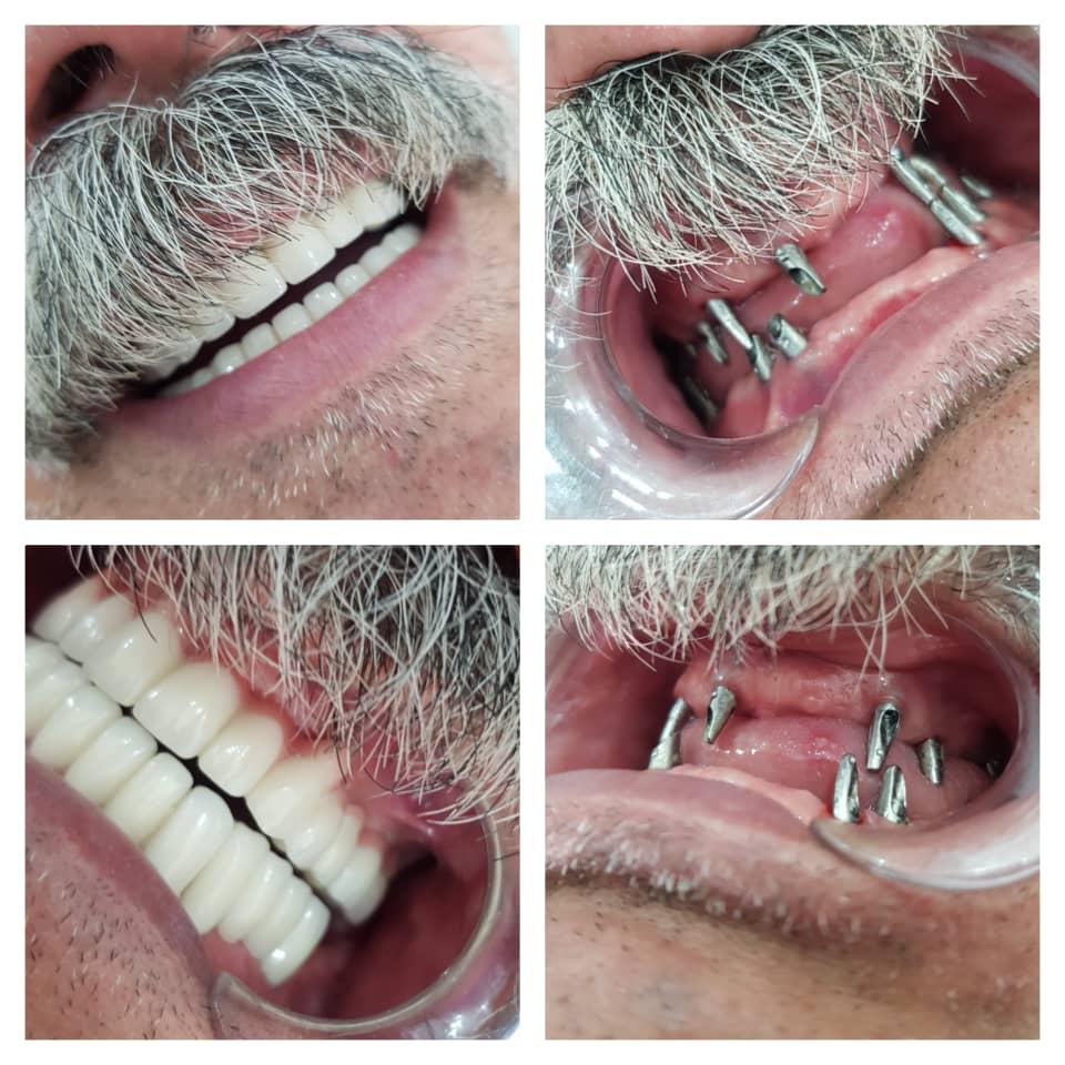 دکتر ممقانی – دندانپزشک استانبول ترکیه