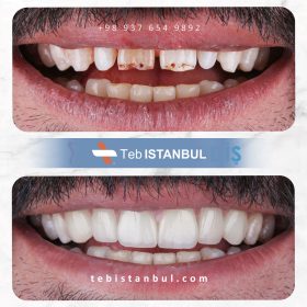 کلینیک دندانپزشکی در استانبول - طب استانبول - مدی هاوس