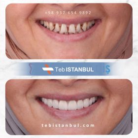 کلینیک دندانپزشکی در استانبول - طب استانبول - مدی هاوس