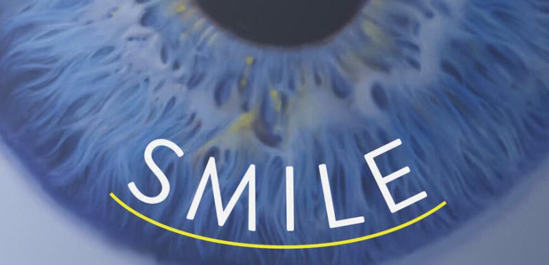 عمل ReLEx SMILE ریلکس اسمایل در ترکیه
