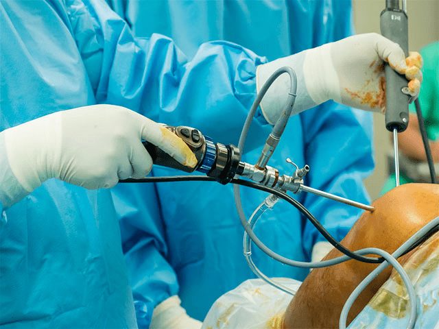 جراحی سنتی ارتوپدی در مقابل جراحی آرتروسکوپی در ترکیه